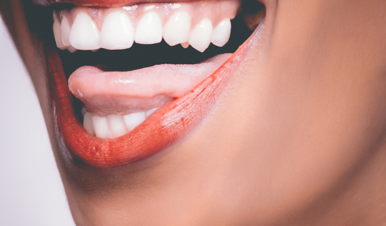 Have You Tried These 4 Teeth Whitening Hacks Yet?